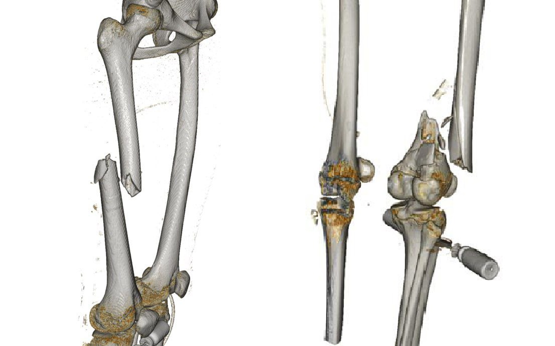 Саратовские врачи рассказали о травмах и лечении пострадавших в ДТП подростков